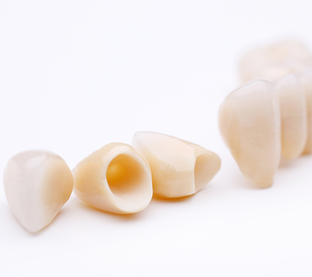 Peabody Dental Crowns and Dental Bridges