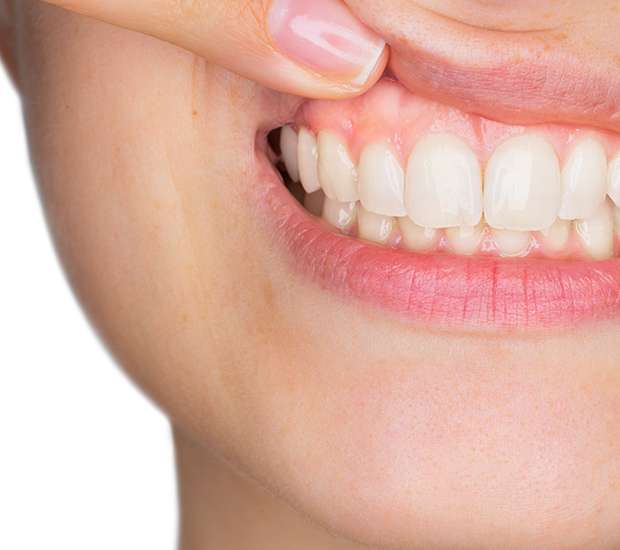 Peabody Gum Disease